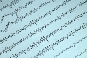 504 plan accommodations. A close-up of a medical graph or chart, possibly an eeg or ecg, displaying wavy, irregular lines on a light blue background highlights the need for 504 accommodations for epilepsy.