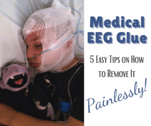 A young boy undergoing an eeg with medical glue on his head, the boy is sleeping and clutching his favorite doll